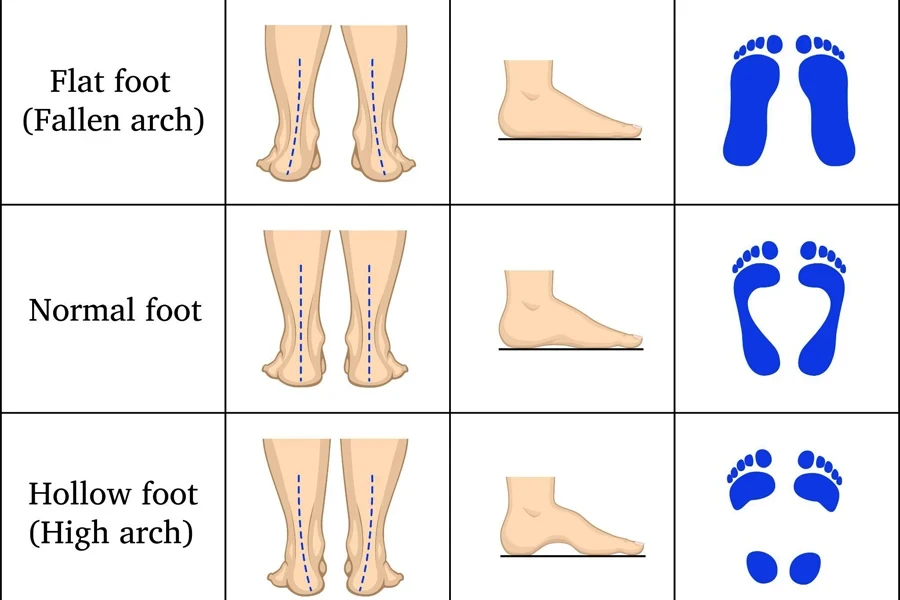 Formes de pied