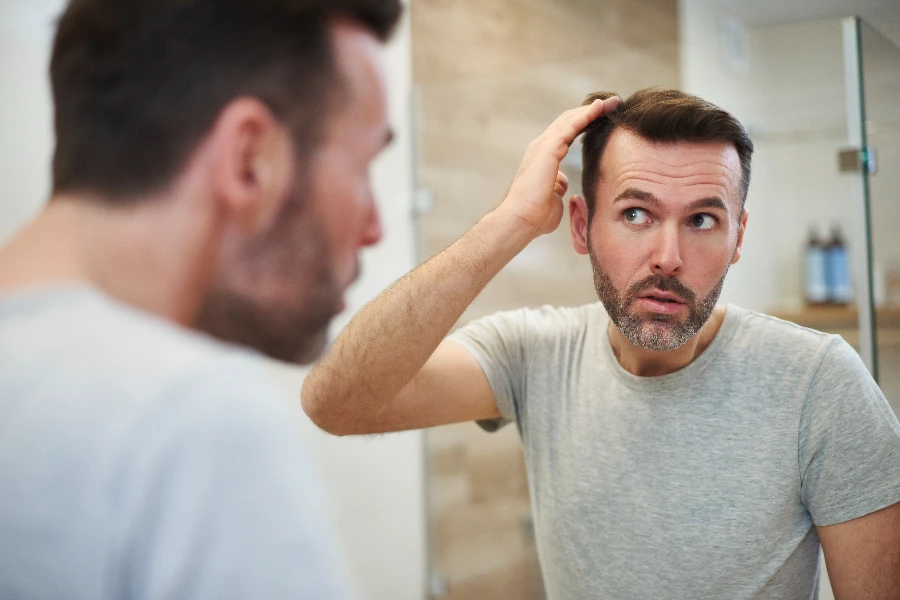 Pria dewasa khawatir tentang rambut rontok