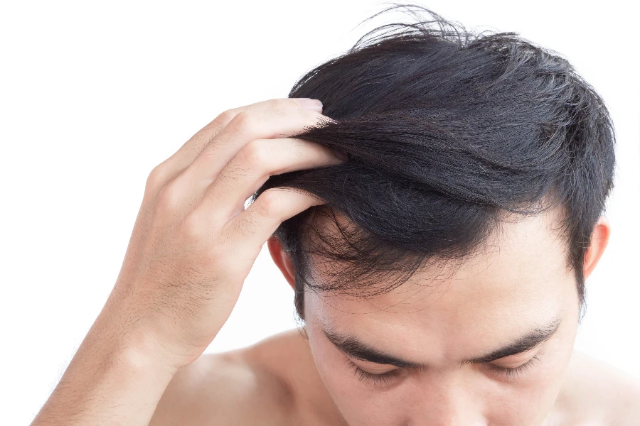 Sağlık tıbbi ve şampuan ürün konsepti için genç adam ciddi saç dökülmesi sorunu