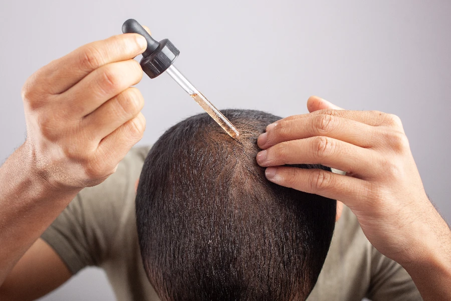 óleo de minoxidil, fundo branco jovem homem caucasiano aplica óleo essencial no couro cabeludo com um conta-gotas