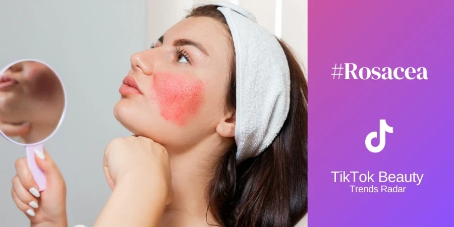 Seorang wanita muda yang cantik memegang cermin yang memperlihatkan rosacea di pipinya. Kulit yang sangat sensitif dan radang.