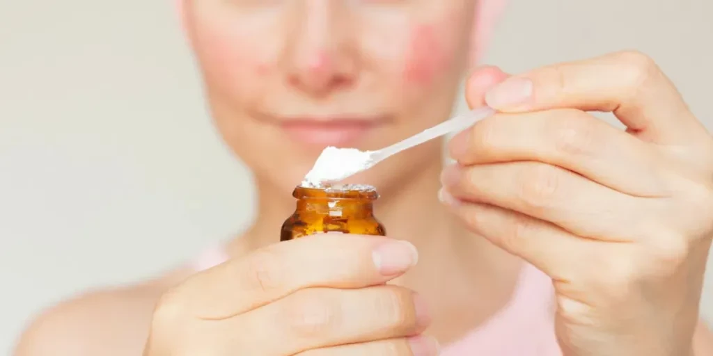 A young caucasian woman suffering from chronic rosacea disease in the acute stage holding a jar of therapeutic ointment in front of her for application to the skin of the face