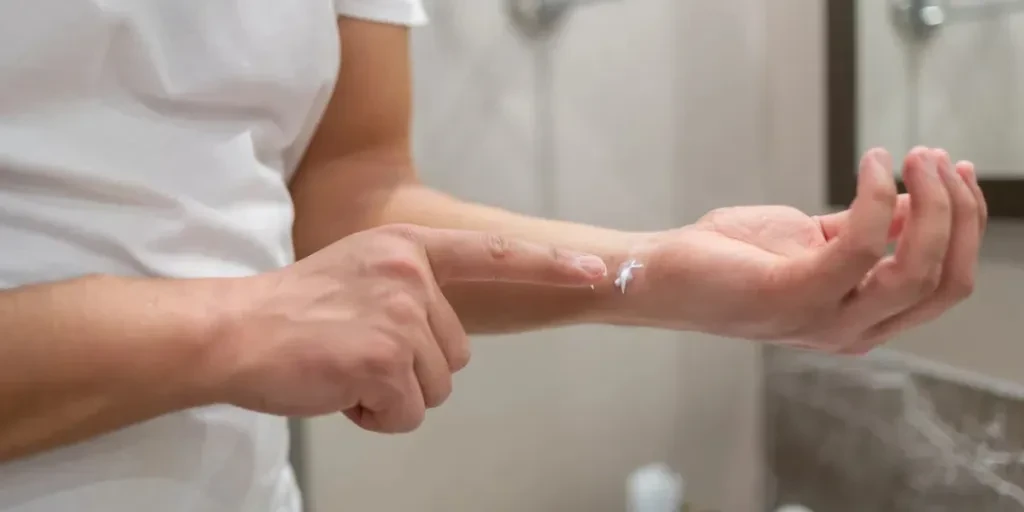 Man Applying Ointment To Eczema Dermatitis