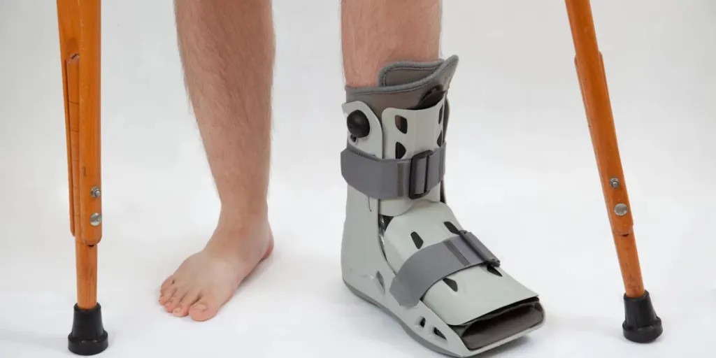 jambe cassée dans une botte orthopédique sur fond blanc