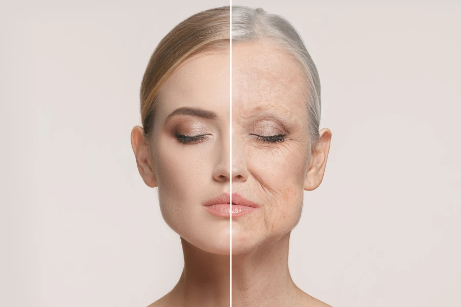 example of anti aging before and after imagery