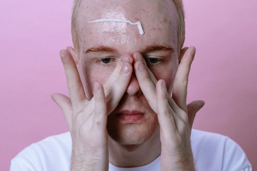 Man with textured skin applying moisturizer