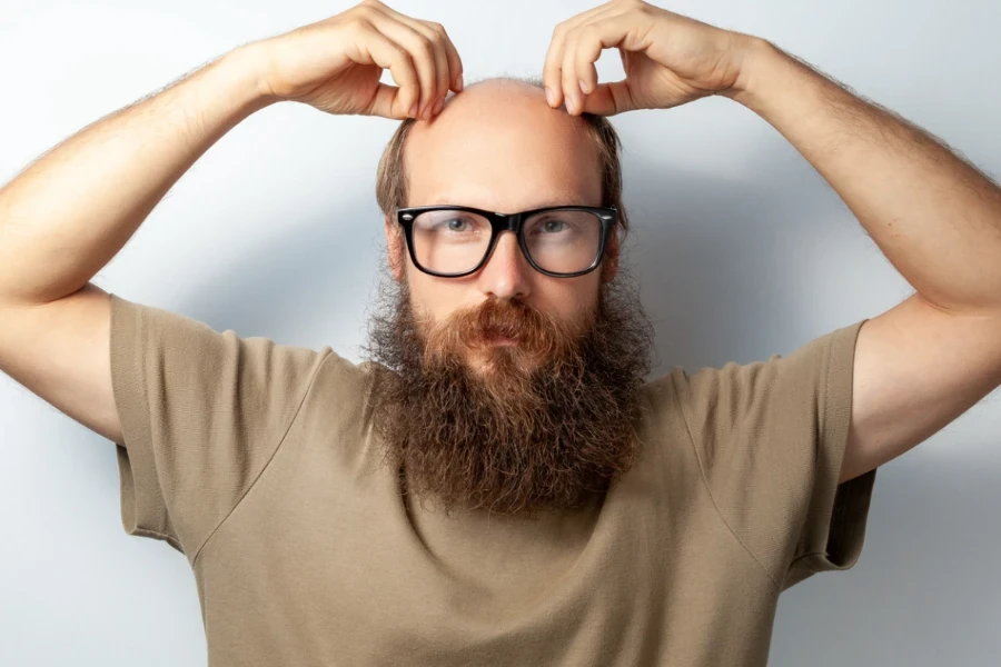 Un giovane che soffre di caduta dei capelli