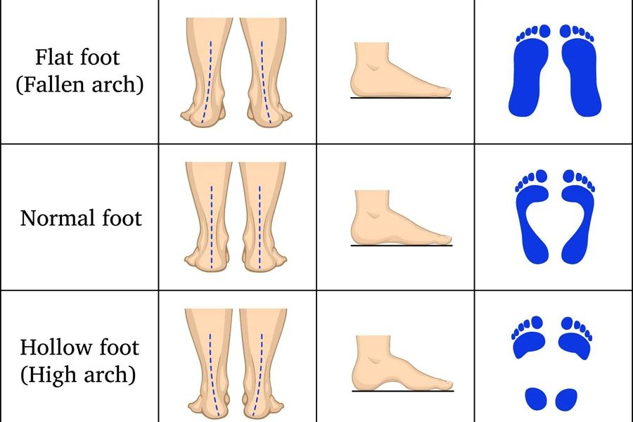 Formas del pie