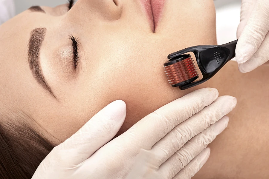 Female patient receiving therapy session with derma rollers