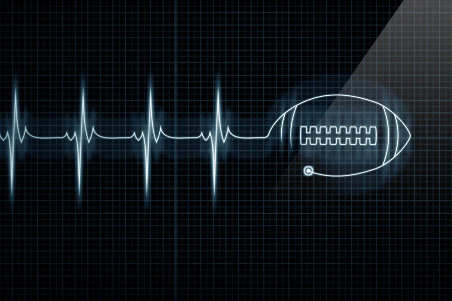 monitorización de la frecuencia cardíaca