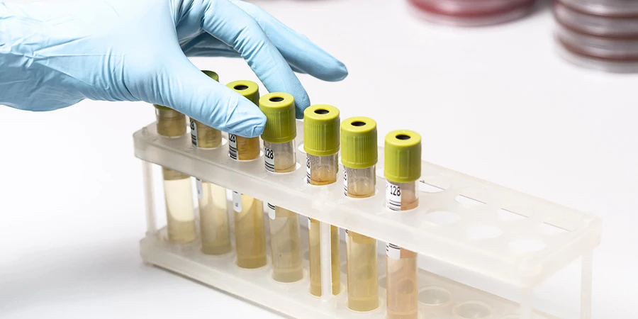 Laboratuvarda sarı sıvı içeren test tüpleri