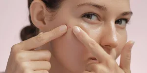 Woman touching the area around a pimple on her face