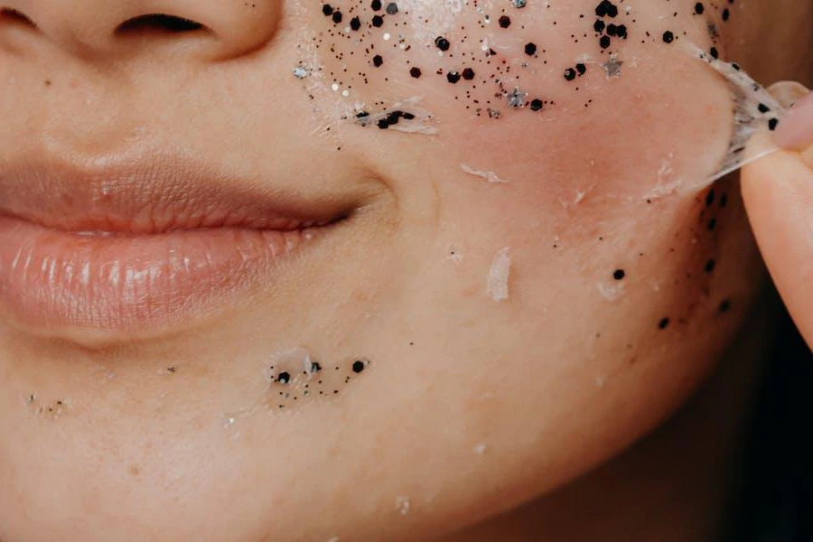 Person pulling off an exfoliating chemical peel