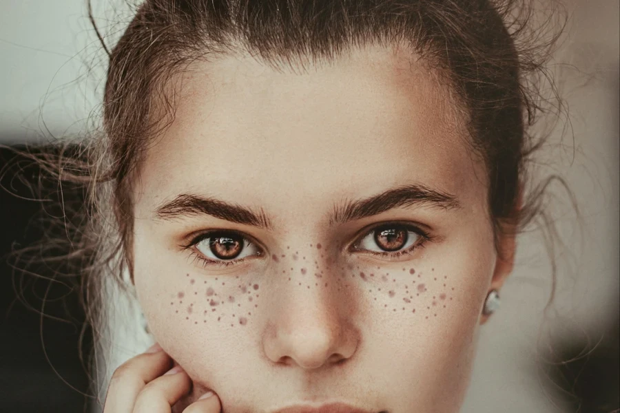 Person with brown eyes with faux freckles