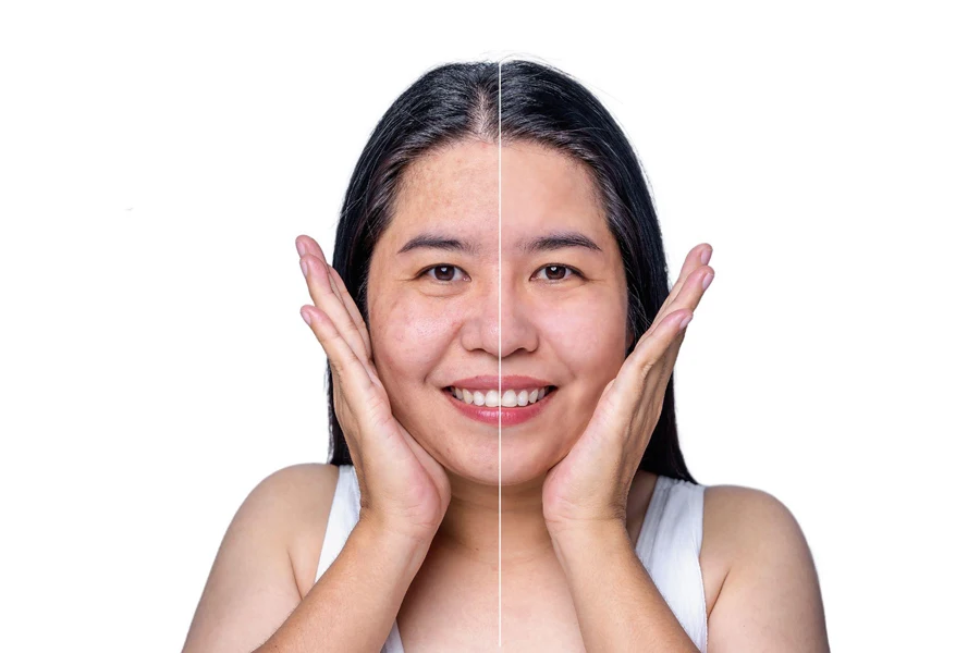comparison between skin care and no skin care