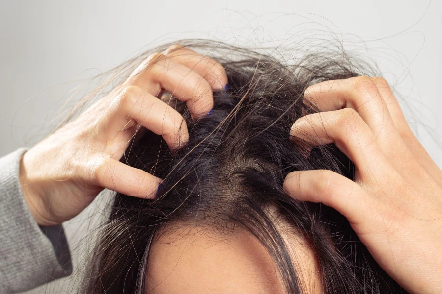 a young woman scratches her scalp and hair with her fingers