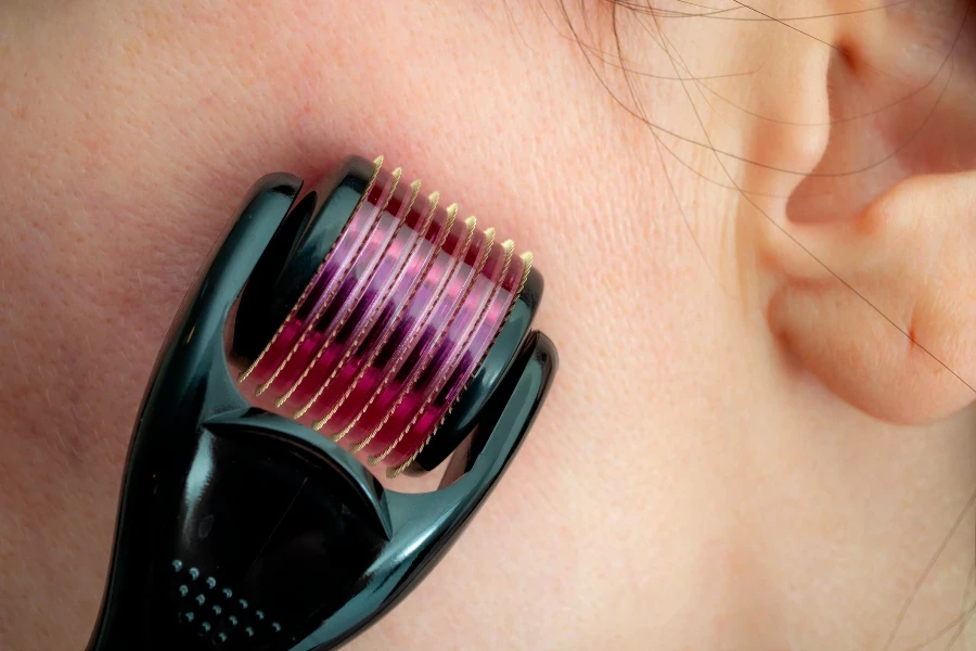 Mesotherapy or microneedle therapy