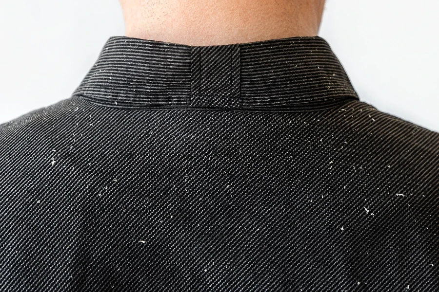 Close up view of person's shoulders in black shirt covered with dandruff
