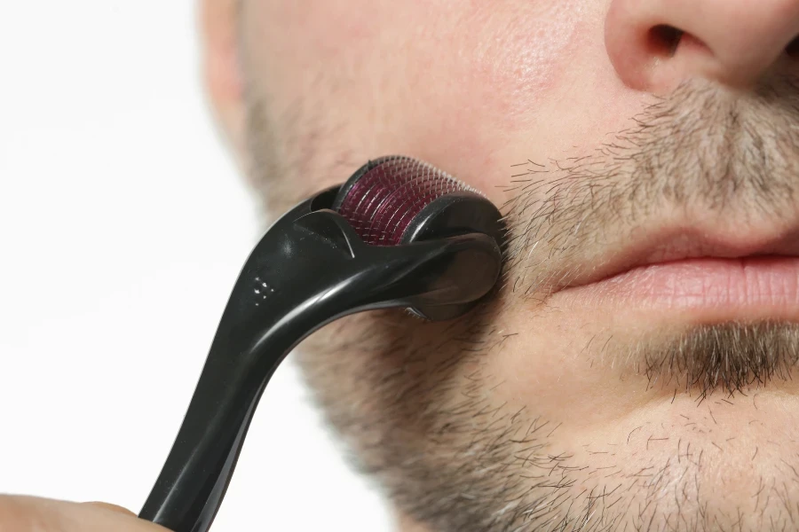 Facial massage with microneedle dermaroller for the treatment of scars
