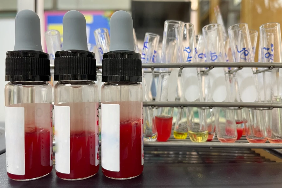 Crossmatching laboratory testing
