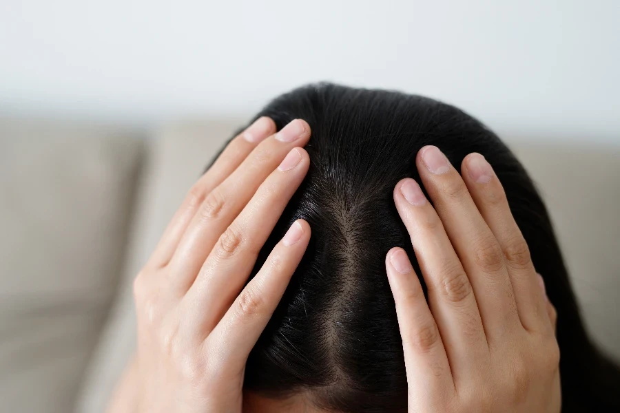 A woman has problems with hair and scalp
