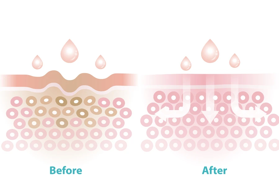 Before and after skincare reduce wrinkles vector illustration isolated on white background

