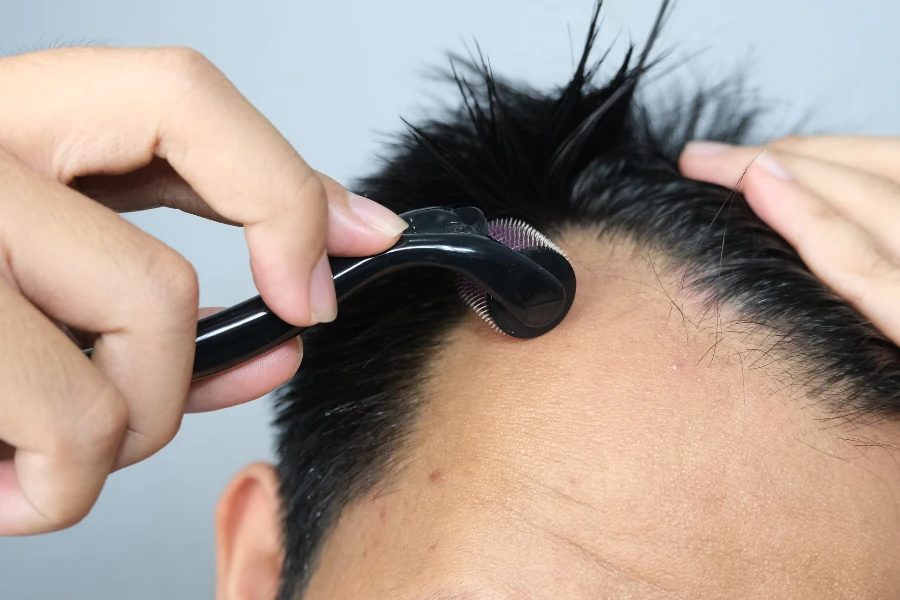 Close up of man applying derma roller to prevent hair loss and to promote hair growth on scalp