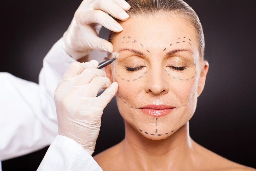 middle aged woman with correction marks preparing for plastic surgery
