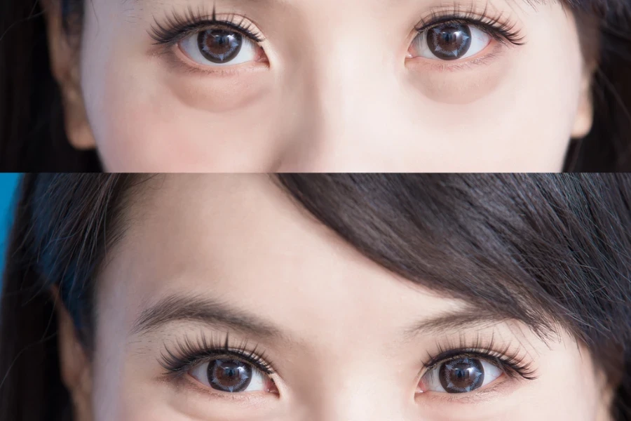 woman eye bags before and after on the blue background
