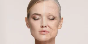 Portrait of beautiful woman with problem and clean skin