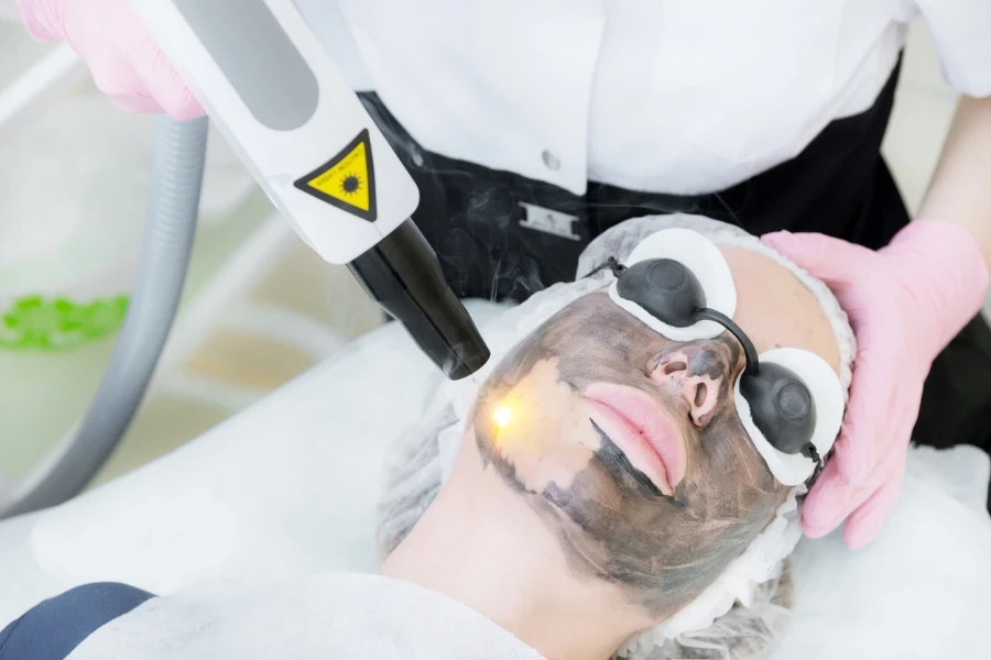 Close-up carbon face peeling procedure
