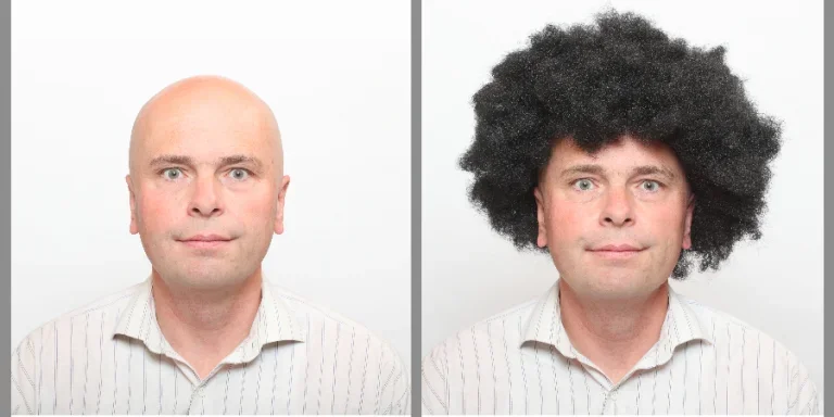 Hairless man and man with beautiful hair