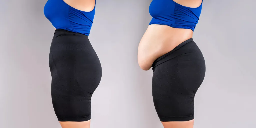 A close up of a woman before and after using waist shaping shorts