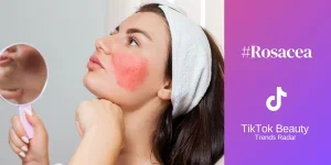 A young beautiful woman holds a mirror showing rosacea on her cheeks. Hypersensitive skin and inflammation.