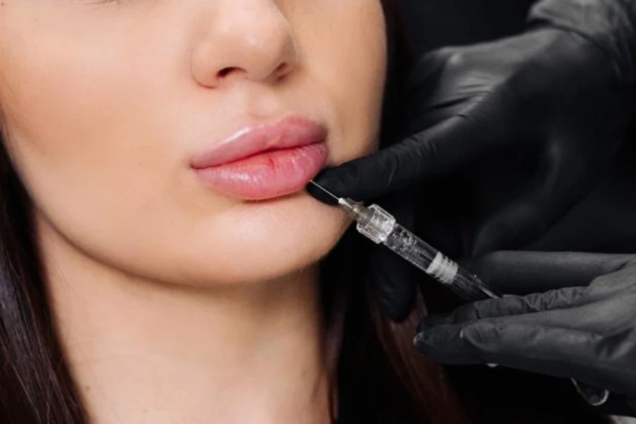 Lip augmentation procedure