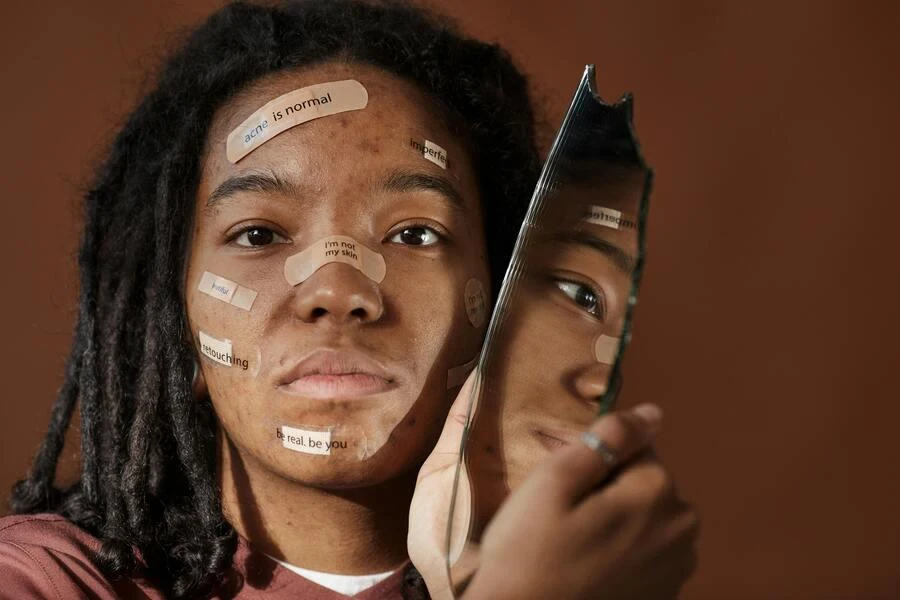 Woman covering acne with band-aids