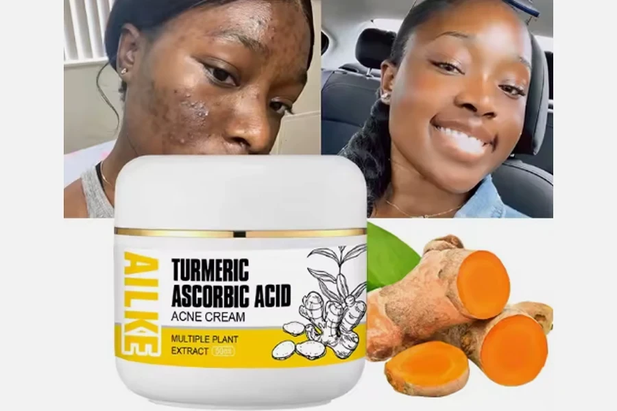 Boost Luster Turmeric Herbal Face Cream Whitening And Acne Removal Pimple Face Anti Acne Cream