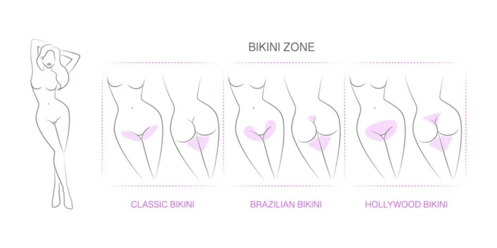 The different bikini zones for waxing procedures