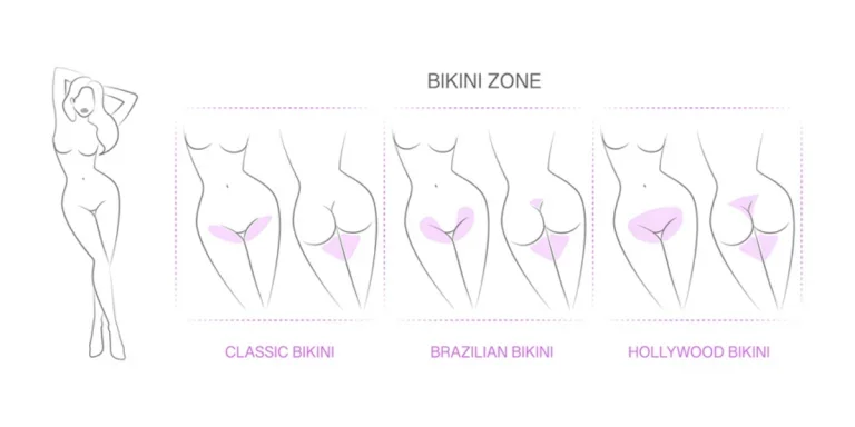 The different bikini zones for waxing procedures