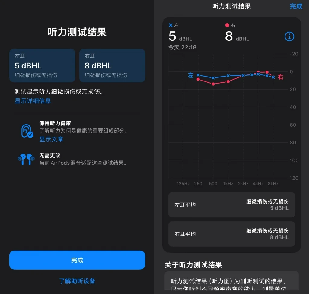 Personal hearing profile chart