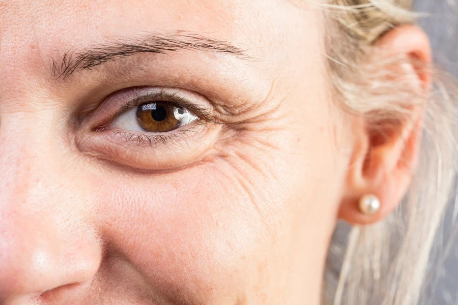 Woman with brown eyes and crow’s feet on face