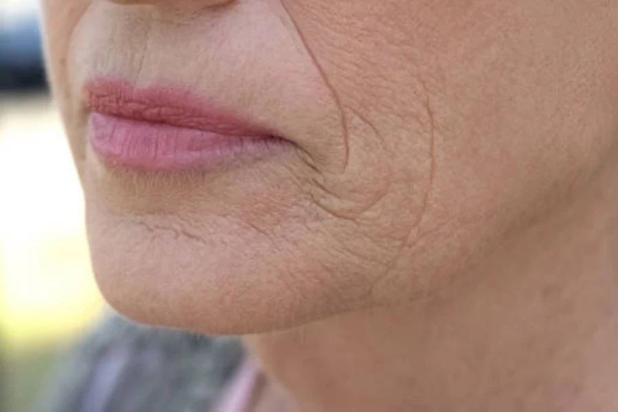 Woman with light pink lips showing her smile lines