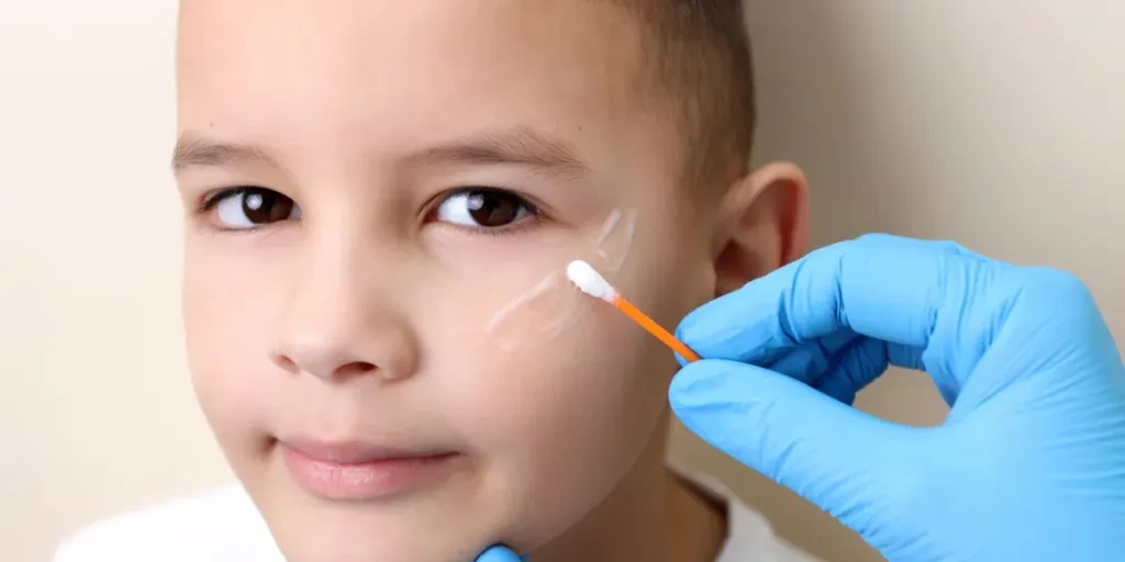 he scar on the boy's face is treated with ointment