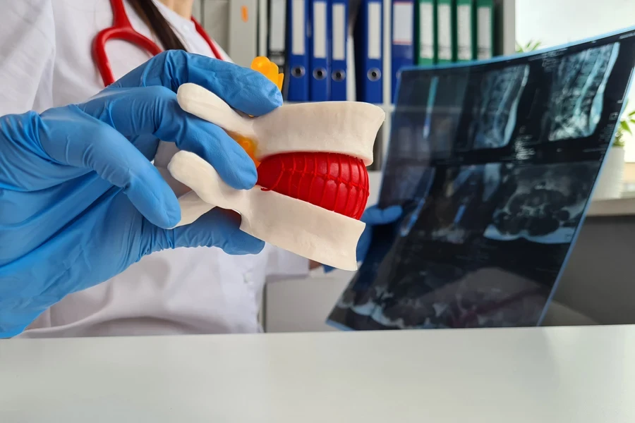 A doctor holding a anatomical model of a vertebrae