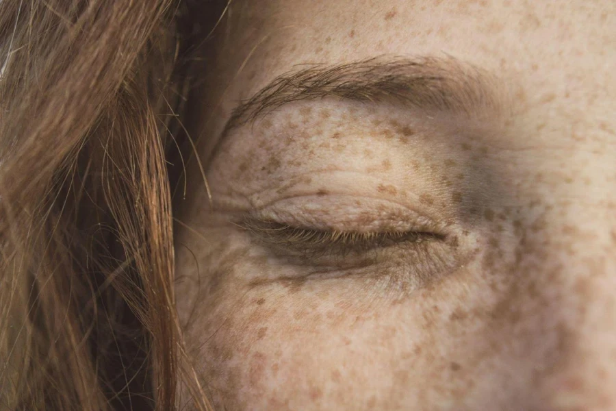 A close-up shot of woman with wrinkles and spots