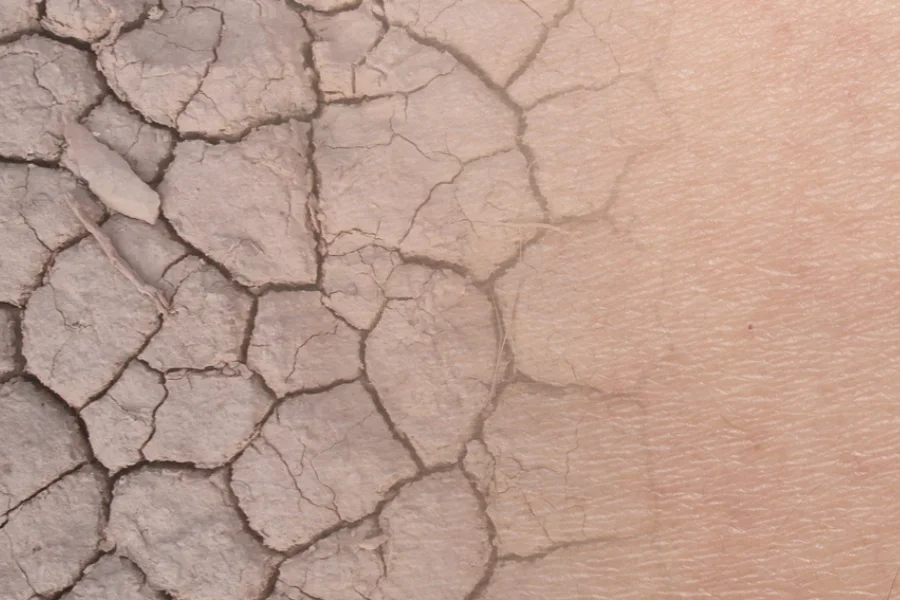 Сыворотка с керамидами преображает сухую кожу, делая ее гладкой и увлажненной