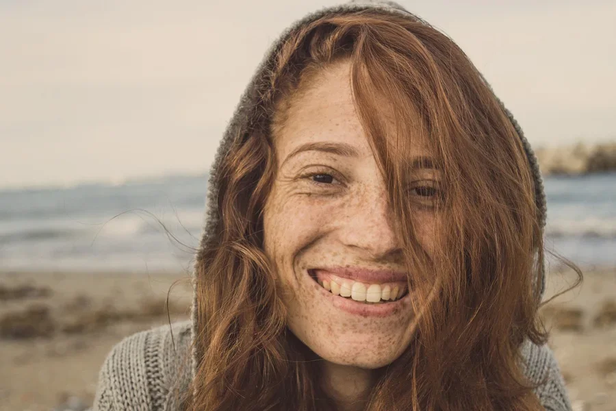 A girl having freckled skin
